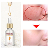 Collagen White Rice Face Serum Hyaluronic Acid Essence