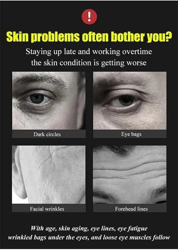 Anti-Aging Wrinkle Cream-(BUY 2 GET 1 FREE🎁BUY 3 GET 2 FREE🎁BUY 5 GET 3 FREE)