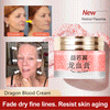 2024 NEW DRAGONS BLOOD EASY CREAM (BUY 3 GET 5 FREE)
