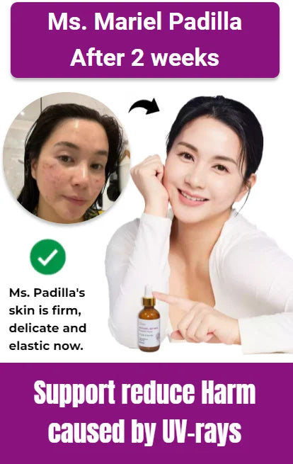 Bakuchiol Retinol Anti Aging Whitening,Renewing Skin Reduce Melasma,Freckles Fading Dark Spots
