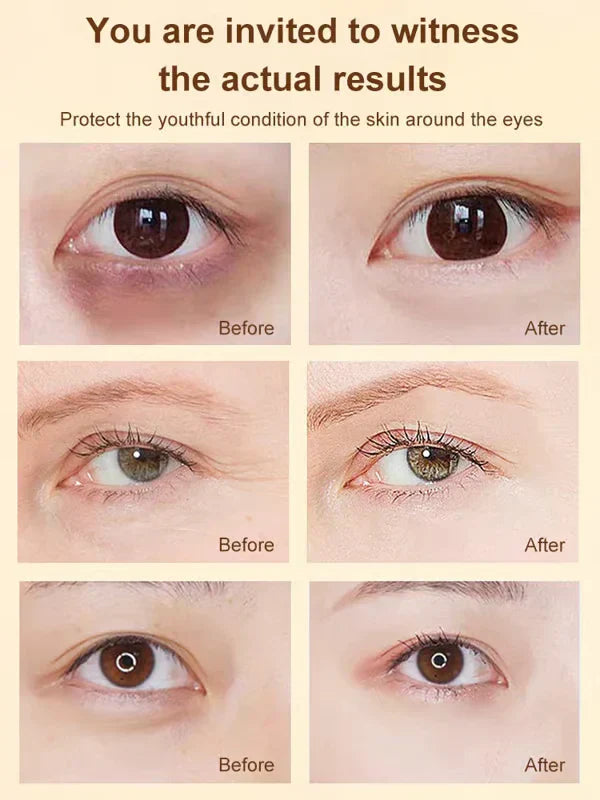 🎁BUY 1 GET 1 FREE🔥 DINKISS LUTEIN EYE ESSENCE OIL