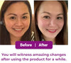 Bakuchiol Retinol Anti Aging Whitening,Renewing Skin Reduce Melasma,Freckles Fading Dark Spots